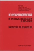 De overkappingsprothese op natuurlijke pijlerelementen en implantaten De overkappingsprothese op natuurlijke pijlerelementen en implantaten