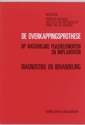 De overkappingsprothese op natuurlijke pijlerelementen en implantaten De overkappingsprothese op natuurlijke pijlerelementen en implantaten