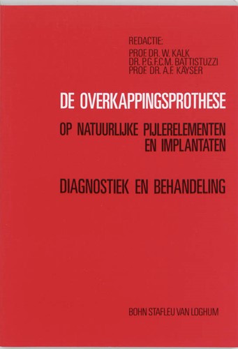 De overkappingsprothese op natuurlijke pijlerelementen en implantaten De overkappingsprothese op natuurlijke pijlerelementen en implantaten