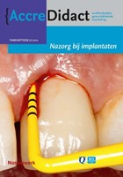 AccreDidact Nazorg bij implantaten Nazorg bij implantaten