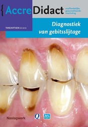 AccreDidact Diagnostiek van gebitsslijtage Diagnostiek van gebitsslijtage