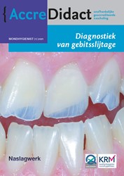 AccreDidact Diagnostiek van gebitsslijtage