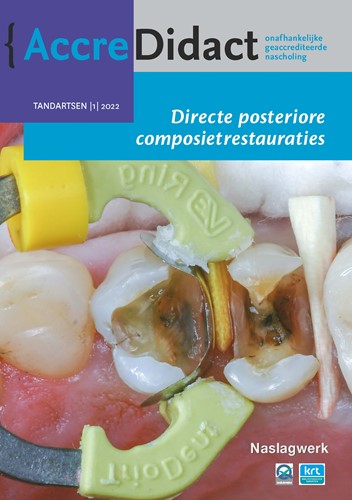AccreDidact Directe posteriore composietrestauraties