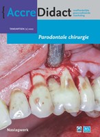 AccreDidact Parodontale chirurgie