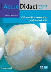 AccreDidact Calciumsilicaatcementen in de endodontie